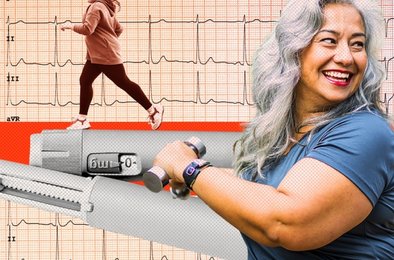 препарат, похудение, Альцгеймер, мозг, деменция