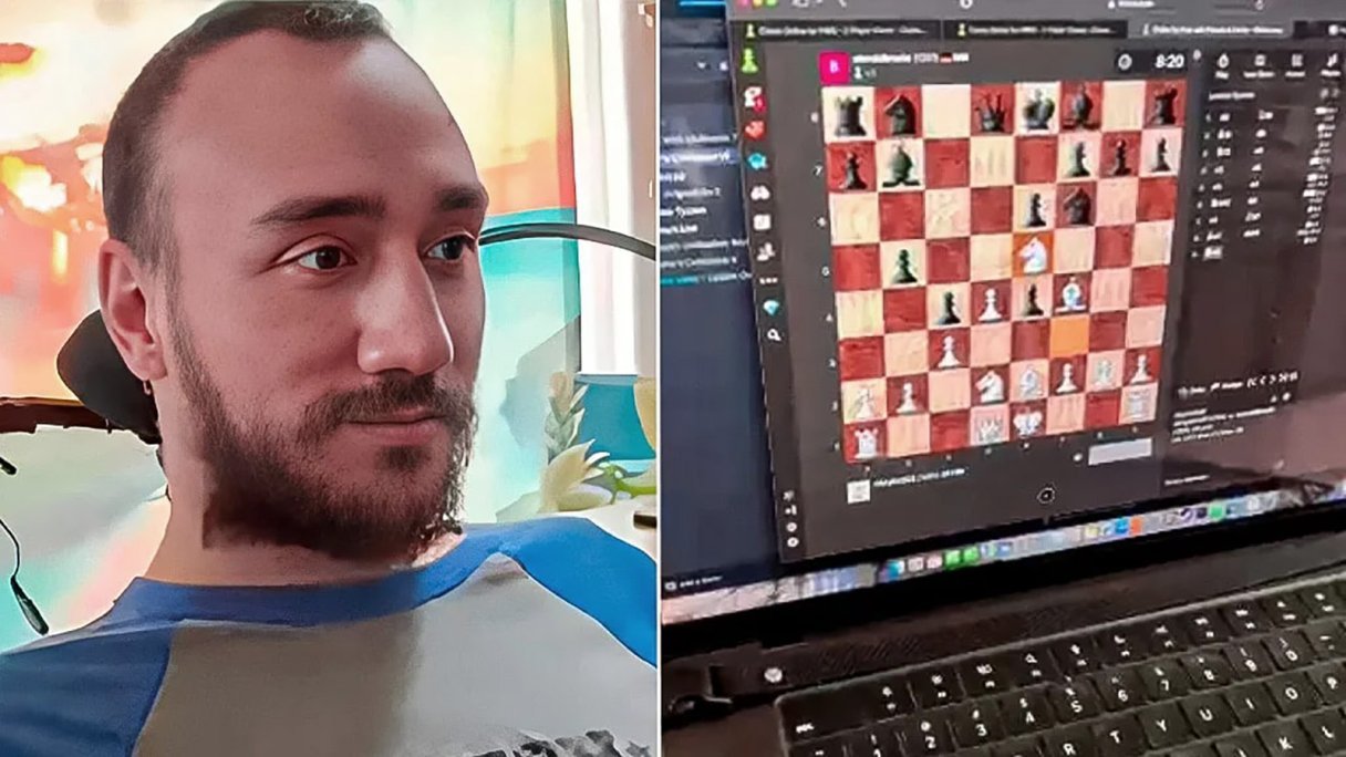 ДЦП, нейроинтерфейс, шахматы, мозг, технологии
