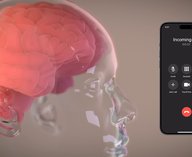 Neuralink, имплант, Маск, мозг, речь