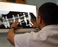 импланты, кости, медицина, производство, технология