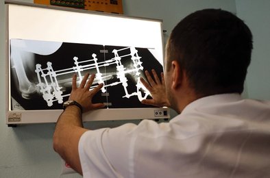 импланты, кости, медицина, производство, технология