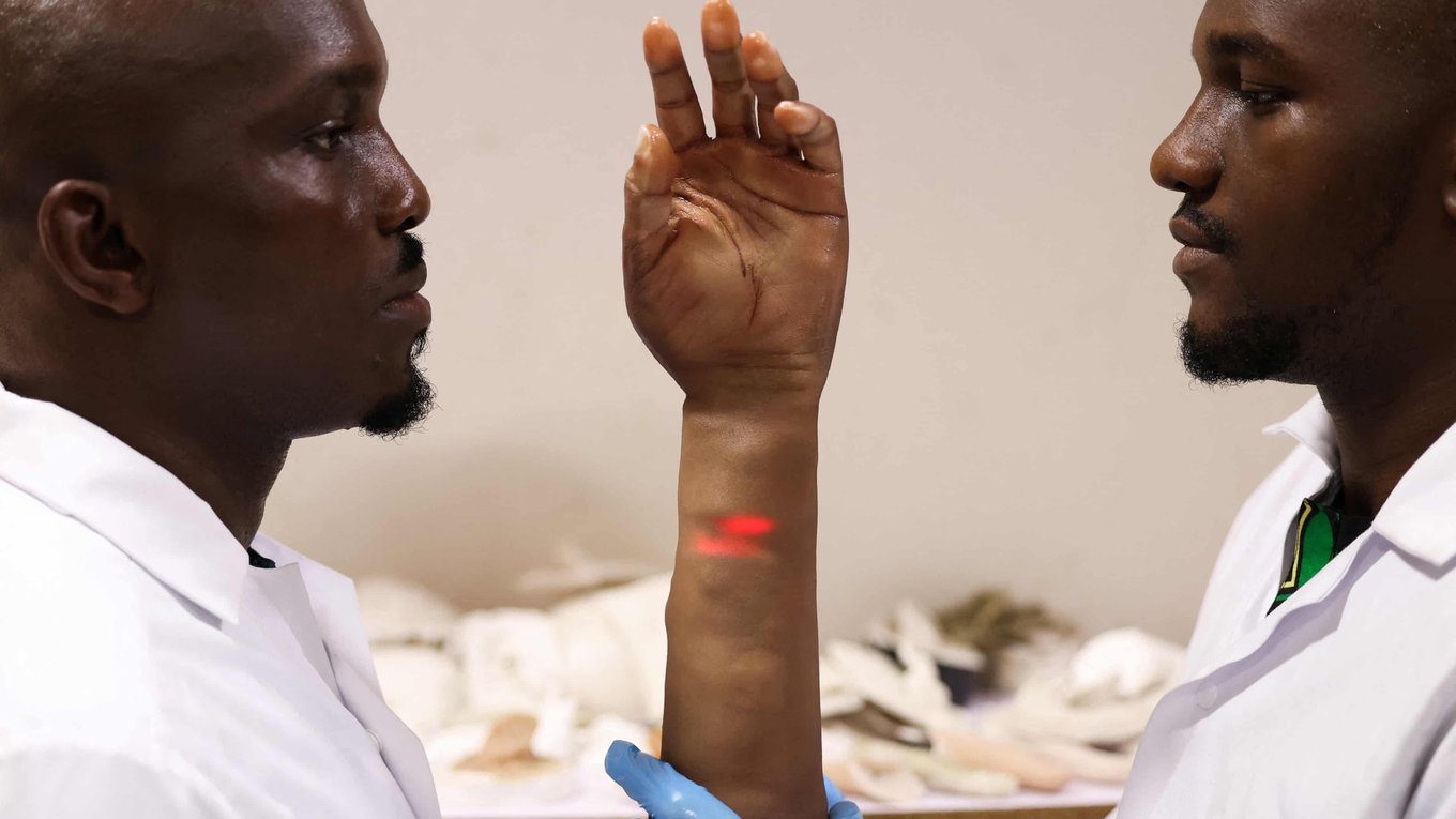 Нигерия, протезы, технология, африканцы, компания