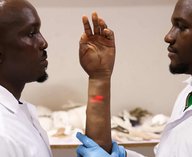 Нигерия, протезы, технология, африканцы, компания