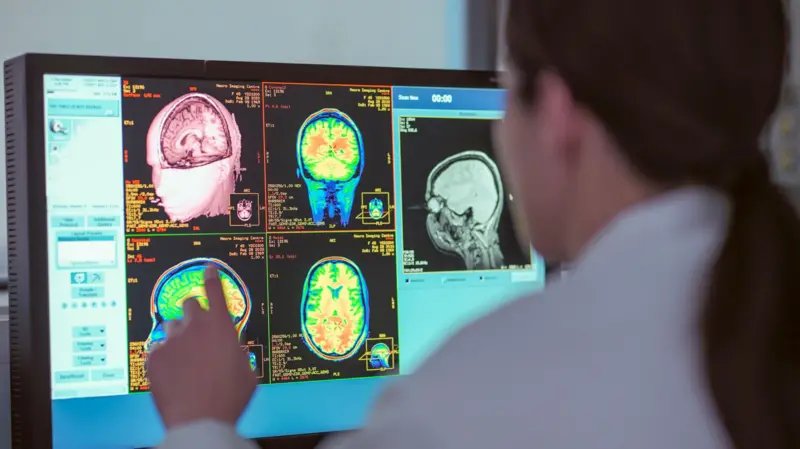 мозг, нейронаука, возраст, исследование, развитие