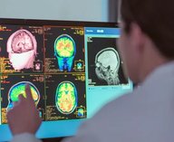 мозг, нейронаука, возраст, исследование, развитие