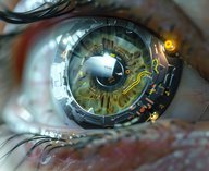 протез, глаз, разработка, Петербург, технология