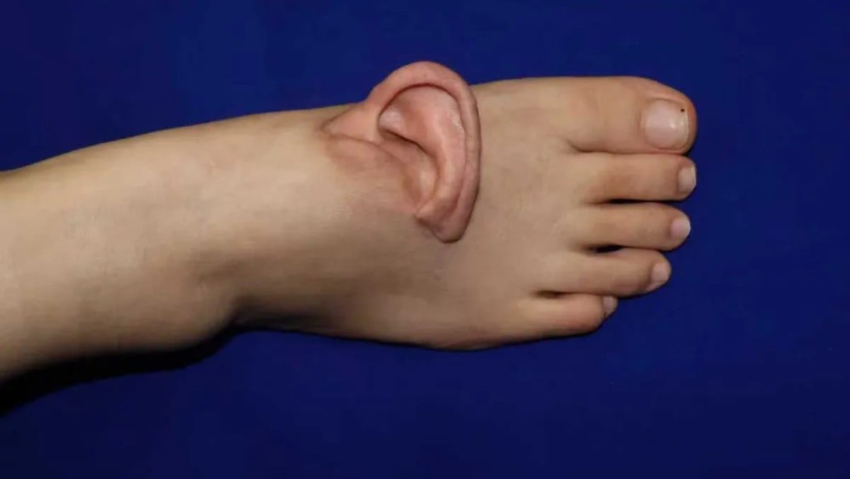 медицина, хирурги, операция, трансплантация, инновации