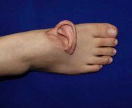 медицина, хирурги, операция, трансплантация, инновации