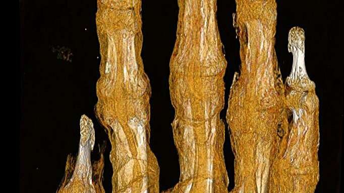 мумия, остеопороз, египет, томография, археология