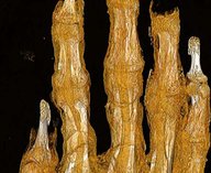 мумия, остеопороз, египет, томография, археология