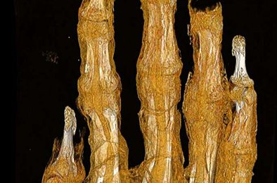 мумия, остеопороз, египет, томография, археология