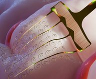 микроэлектроды, нейроинтерфейс, мозг, имплантация, нейротехнологии