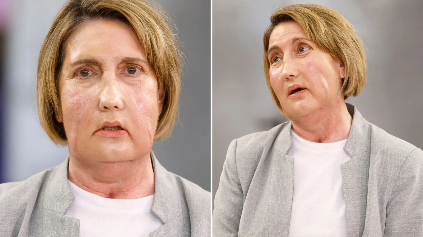 Лицо, пересадка, эвтаназия