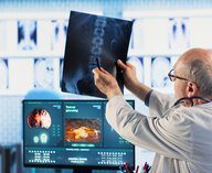 имплантат, кости, медицина, 3D, технология