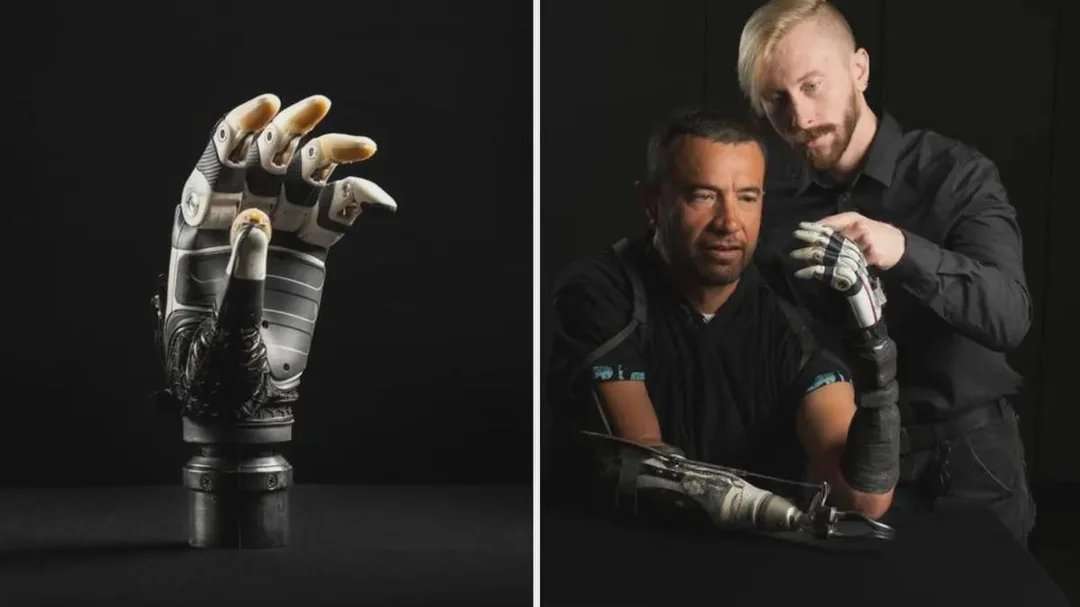 нейропротез, протез, нейросеть, сенсоры, робототехника