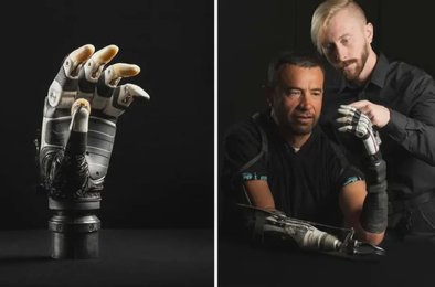 нейропротез, протез, нейросеть, сенсоры, робототехника