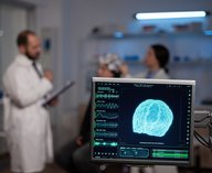 прибор, мозг, операция, излучение, технология