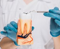 кариес, наклейка, стоматология, лечение, технология